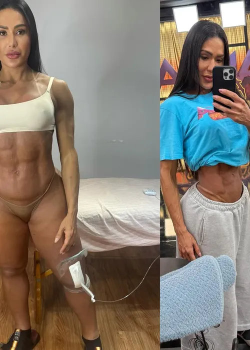 
					Gracyanne mostra antes e depois de cirurgia e explica mudanças de peso
				
				