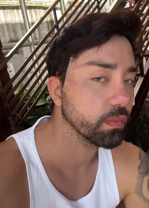 
					Rico Melquiades é desmascarado após aparecer com olhos azuis
				
				