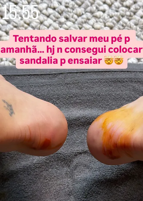 
					Virginia Fonseca se machuca, não consegue sambar e pede 'socorro'
				
				