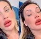 
                  Andressa Urach para em posto de saúde e faz alerta aos fãs