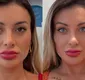 
                  Andressa Urach passa por procedimento e surge com rosto ensanguentado