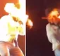
                  Cantor Léo mostra rosto após ser atingido por fogo em show