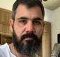 
                  Juliano Cazarré passa por nova cirurgia após acidente doméstico