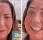 
                  Mãe de Virginia aparece irreconhecível após cirurgia nos olhos