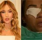 
                  Mulher diz ter ficado cega ao usar produto de Virginia Fonseca