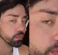 
                  Rico Melquiades é desmascarado após aparecer com olhos azuis