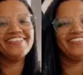 Mulher atacada com ácido pelo ex morre após 17 dias internada