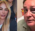 Poliana Rocha atualiza estado de saúde de Leonardo após acidente