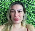 Saiba real estado de saúde de Andressa Urach após surto e 'apagão'