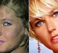 Web resgata Xuxa expondo rinoplastia indicada por médico em elevador