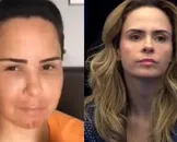 BBB 26: foto de Ana Paula Renault antes de cirurgia plástica choca web