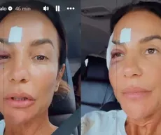 Desmaio de Ivete Sangalo: o que é síndrome vasovagal, causa do susto