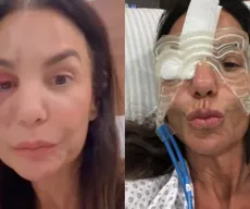Ivete Sangalo surge com equipamento inusitado no rosto em recuperação