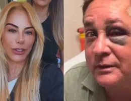 Poliana Rocha atualiza estado de saúde de Leonardo após acidente