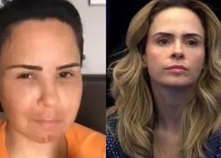 BBB 26: foto de Ana Paula Renault antes de cirurgia plástica choca web