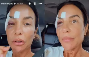 Melhor amigo de Ivete Sangalo atualiza estado da cantora após cirurgia