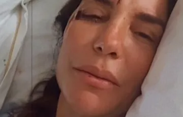 Ivete Sangalo segue internada após cirurgia facial em SP; saiba estado