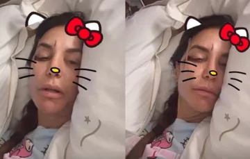 Ivete Sangalo surge com machucado no rosto e explica internação