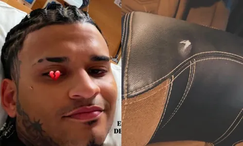 
					Anderson Neiff expõe imagens da van logo após ataque a tiros; VÍDEO
				
				