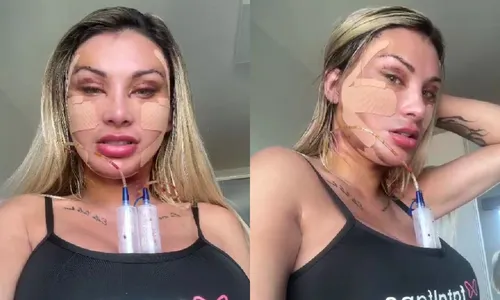 
					Andressa Urach é barrada em imigração após procedimentos estéticos de R$ 240 mil
				
				
