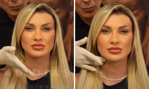 
					Andressa Urach revela 'novo rosto' após combo de cirurgias; veja
				
				