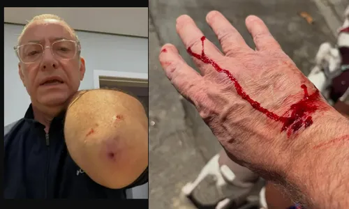 
					Apresentador da Globo é atacado por pitbull e assusta com ferimentos
				
				