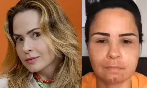 
					BBB 26: foto de Ana Paula Renault antes de cirurgia plástica choca web
				
				