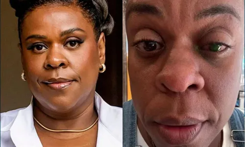 
					Cacau Protásio atualiza estado de saúde após cegueira em um olho
				
				