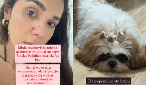 
					Ex-BBB Gizelly Bicalho expõe ferimento após ataque de cachorro; FOTO
				
				