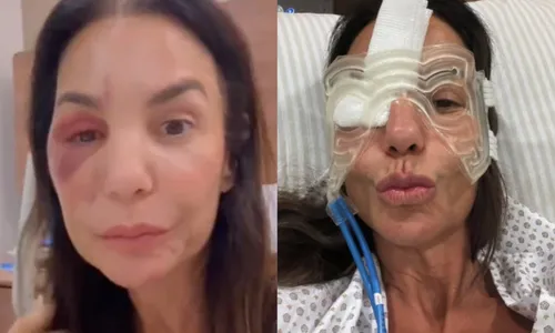 
					BBB 26: Ivete Sangalo confirma presença em festa após cirurgia
				
				