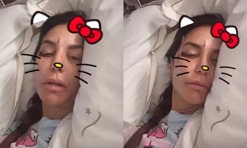 
					Ivete Sangalo surge em carro e não confirma cirurgia; VÍDEOS
				
				