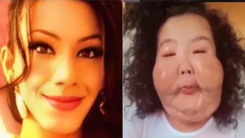 
					Juju do Pix exibe rosto após cirurgia delicada para tirar óleo mineral
				
				