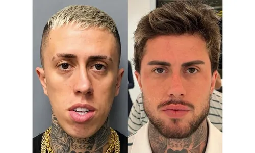 
					MC Daniel choca com antes e depois de procedimentos: 'Fez milagre'
				
				