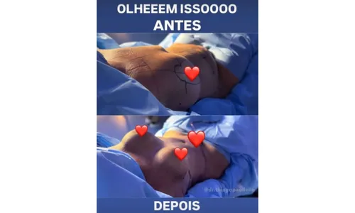 
					Mãe de Virginia choca com antes e depois de cirurgia plástica; veja
				
				