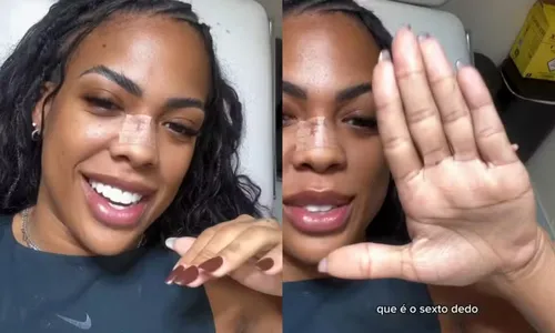 
					Marvvila faz cirurgia e retira sexto dedo da mão: 'Tchau'
				
				
