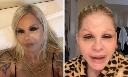 
					Monique Evans surge irreconhecível após cirurgia e faz revelação
				
				