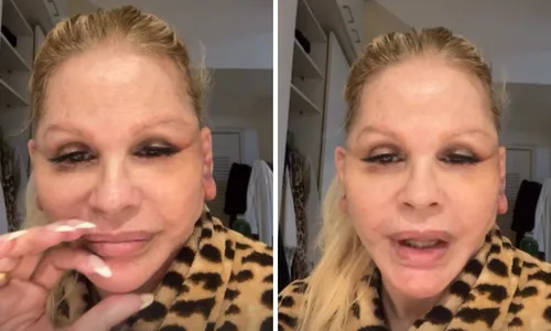 
					Monique Evans surge irreconhecível após cirurgia e faz revelação
				
				