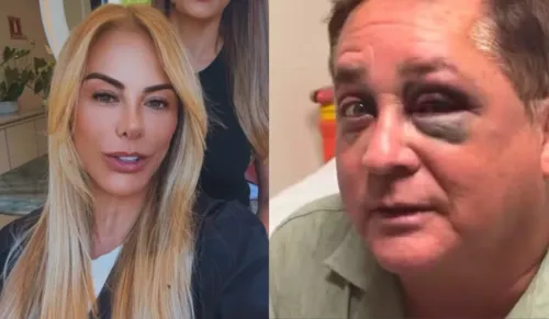
					Leonardo expõe excesso de álcool após fraturar osso do rosto
				
				