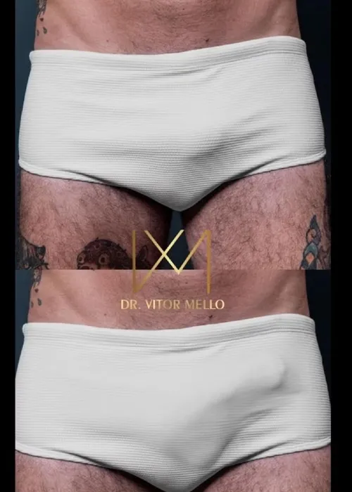 
					Ex-BBB Wagner Santiago choca ao fazer terceiro aumento peniano
				
				