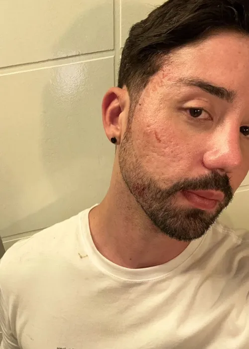 
					Rico Melquiades revela agressão e paralisia facial após briga com ex
				
				