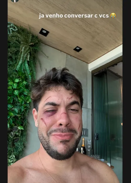 
					Rico Melquiades surge armado na porta de Álvaro Xaro após crítica
				
				