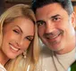 
                  Ana Hickmann exibe álbum de fotos com Edu Guedes e revela casamento
