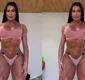 
                  Gracyanne Barbosa faz cirurgia em parte íntima: 'Ficou linda'