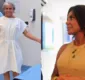 
                  Gretchen abre o jogo e explica motivo de realizar cirurgia íntima