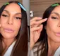 
                  Ivete Sangalo revela que está com titânio no rosto após fratura; VÍDEO
