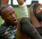 
                  Jogador do Canadá quebra a perna em partida da Copa do Mundo; assista