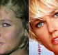 
                  Web resgata Xuxa expondo rinoplastia indicada por médico em elevador