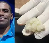 Homem morre após se engasgar com pedaço de beiju na Bahia