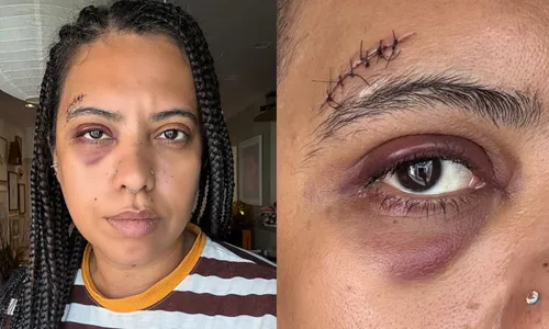 
					Influencer Carla Lemos é agredida e recebe apoio de Ana Paula Renault
				
				