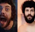 Diogo Defante exibe mudança radical no corpo após retirada de tumor